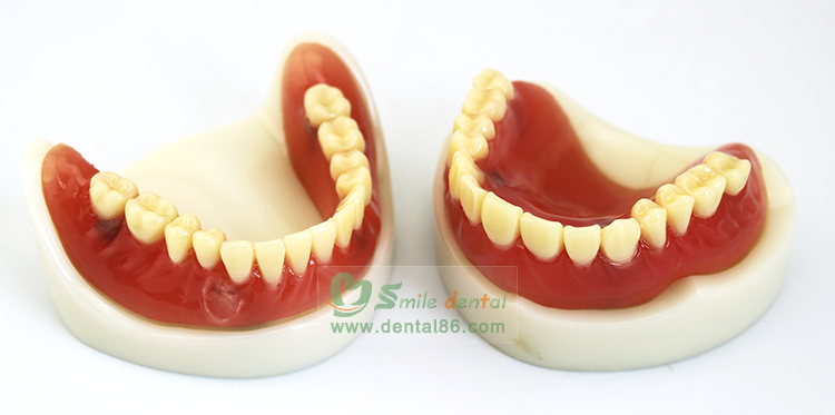 TM-T21 Full Denture Implant Mode